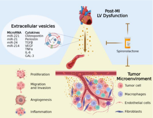 It was a pleasure to have taken part in the research of Prof. Jonathan Leor's group, uncovering a unique pathway connecting heart disease to cancers.    
The study was led by Prof. Leor's MD-PhD student Tal Caller. Special thanks to our lab manager Menachem Motiei and MSc student Idan Katzir for their contribution!
The study was published in Circulation,
doi: 10.1161/CIRCULATIONAHA.123.066911
or- Click on the link below for access!